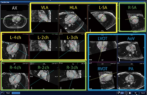 図4　CardioLine＋による全14断面の検出画面