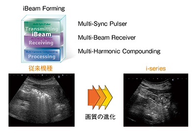 図2　iBeam FormingによるDifferential THI画像の飛躍的な高画質化