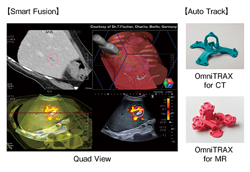 図5　Smart FusionとAuto Track