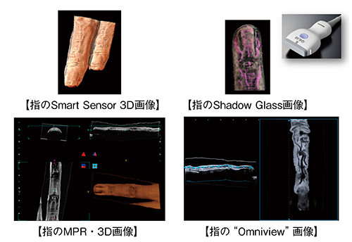 図6　超高周波リニアプローブによるSmart Sensor 3D