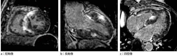 図2　動き補償を併用した3D遅延造影撮像の画像例（MPR）