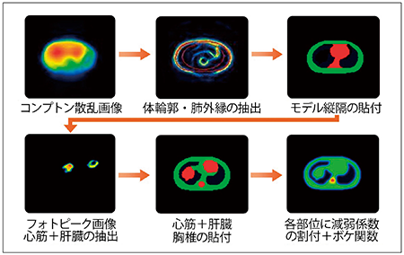 図5　SSPAC法による減弱マップ作成