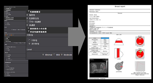図1　BI-RADSレポートの作成