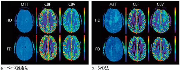 図2　造影剤量が半量（half dose：HD），全量（full dose：FD）のperfusion mapにおけるベイズ推定法とSVD法の比較 （参考文献3）より引用転載）