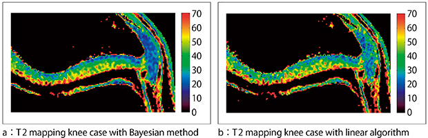 図3　ベイズ推定法（a）および線形近似法（b）による膝軟骨T2マップ （参考文献3）より引用転載）
