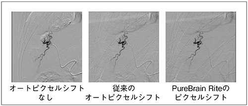 図3　DSAのピクセルシフトの違い