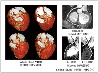 図3　CMR検査の一例