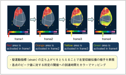 図1　Activation Imagingの概要