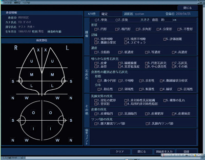 図2　マンモレポート