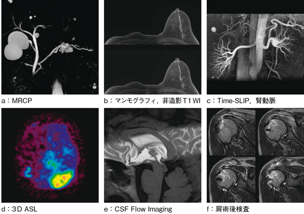 図3　Multi-Phase Transmissionの臨床適応