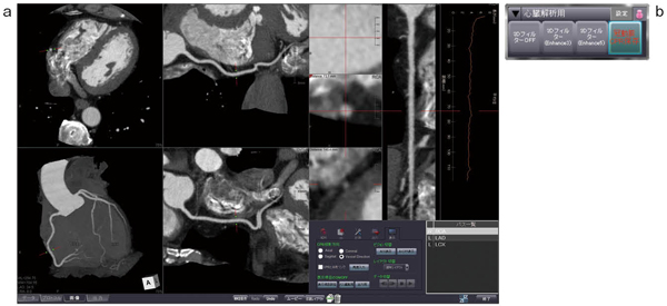 図6　冠動脈解析（a）