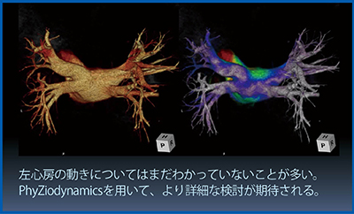 図7　左心房の5Dイメージ