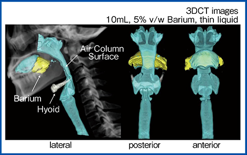 図1　ADCTによる3D動態画像を用いた嚥下動態の観察