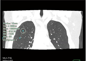 図2　PhyZiodynamicsによるDynamic VOI計測の例