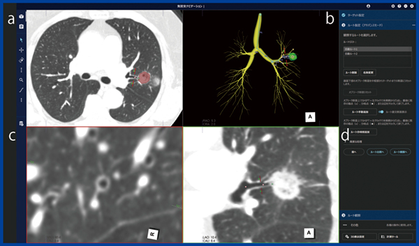 図1　気管支ナビゲーションのルート指定画面 a：アキシャル断面 b：自動抽出された気管支樹 c：ルート直交断面（輪切り表示） d：ルート長軸断面（縦切り表示）