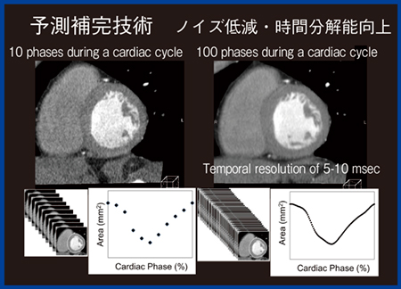 図1　PhyZiodynamicsの要素技術〜予測補完技術