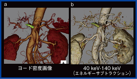 図3　物質密度画像の3D