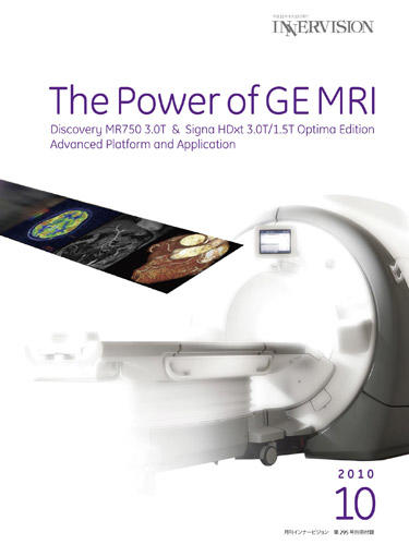 The Power of GE MRI