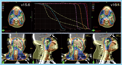 図2　Eclipse v15.6とv16.1の線量分布の比較
