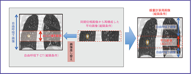 図1　線量計算用画像シリーズの作成