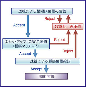 図2　腹部圧迫法でのIGRTワークフロー