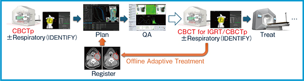 図1　CBCTpのワークフロー（バリアン社より一部画像提供あり）