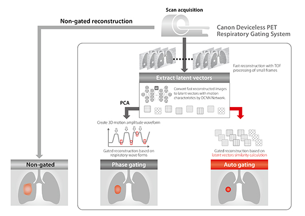 デバイスレスPET呼吸同期システム