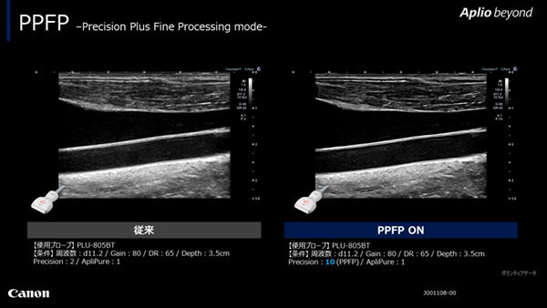 Precision Plus Fine Processing mode（PPFP）