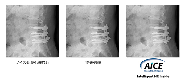 Deep Learningを用いたノイズ低減処理AiCE,Intelligent NR Inside