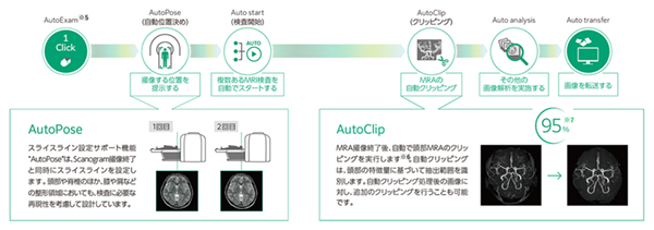 AI技術を活用してMRI操作の負担を軽減 AI技術を活用してMRI操作の負担を軽減