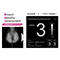 乳房構成解析ソフトウェアBreast Density Assessment（Bda）