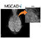 マンモグラフィー診断支援ソフトウェアライセンス MGCAD-i