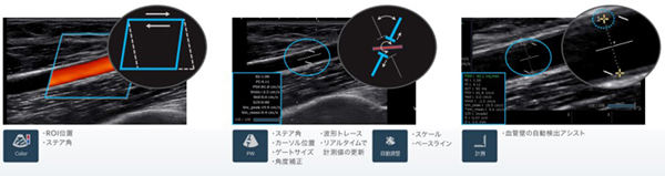 Vascular NAVI機能 Vascular NAVI機能