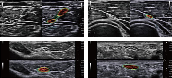 神経を可視化する VisNerve 神経を可視化する VisNerve