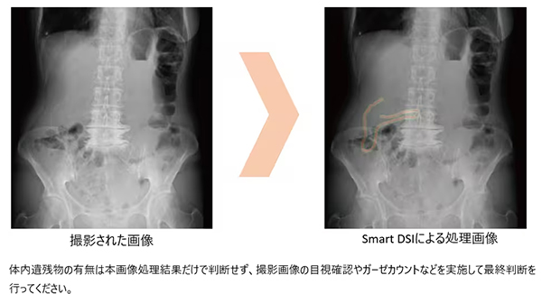 AIによる画像確認支援