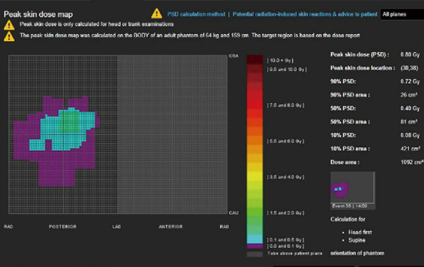 図2　DOSEの入射皮膚線量マップ機能