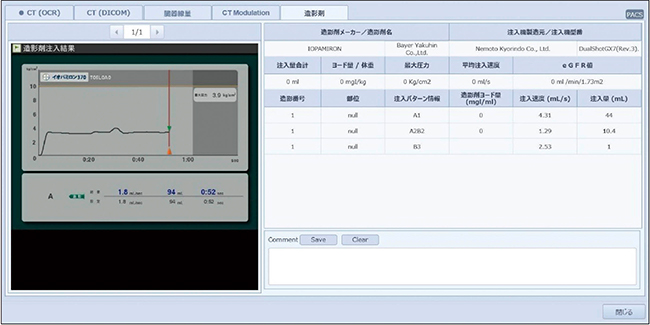 図3　INFINITT DoseMの造影剤情報画面