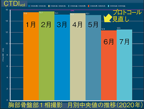 図5　胸部骨盤CTの月別中央値の変動