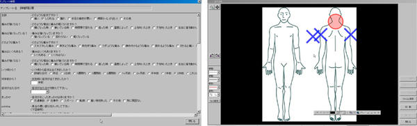 図6　電子カルテのテンプレート（左）とシェーマ（右）として展開