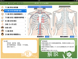 図4　疑似体験による聴診音の学習