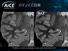 医用画像博覧会 2020　キヤノンメディカルシステムズ - MRI　