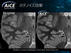 医用画像博覧会 2020　キヤノンメディカルシステムズ - MRI　