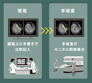 アノテーション機能で，迅速で的確な意志決定をサポート
