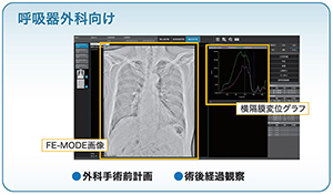 図2　呼吸器外科向け KINOSIS画面