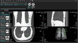 EIRL Chest CT
