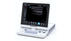 超音波画像診断装置「SONIMAGE HS1」