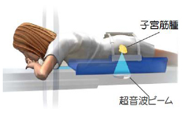 照射イメージ