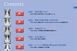 Contents