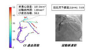 図3 CT虚血指数（Ischemic Index）と冠動脈造影にて評価された冠血流予備量比