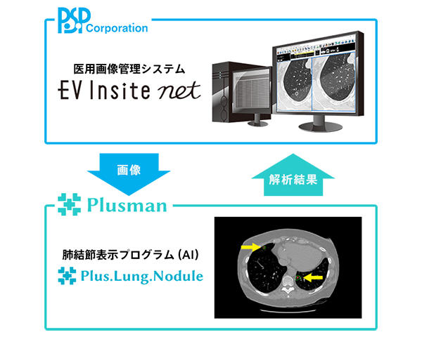 Plus.Lung.Nodule Plus.Lung.Nodule